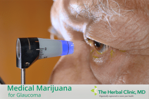 Medical Marijuana for glaucoma Tampa